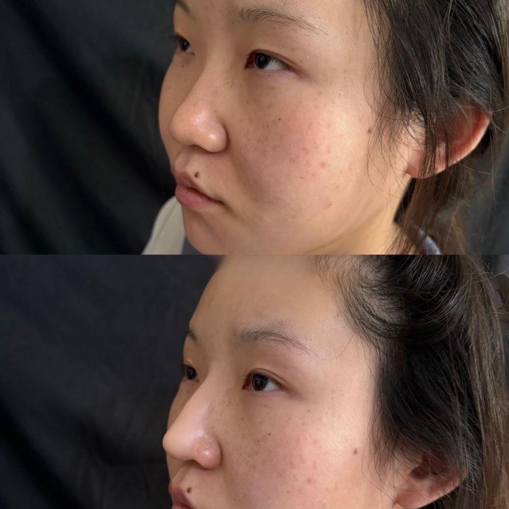    ชุดจมูกปลอมซิลิโคน นุ่ม สบ - J Beauty Makeup บทวิจารณ์และราคา